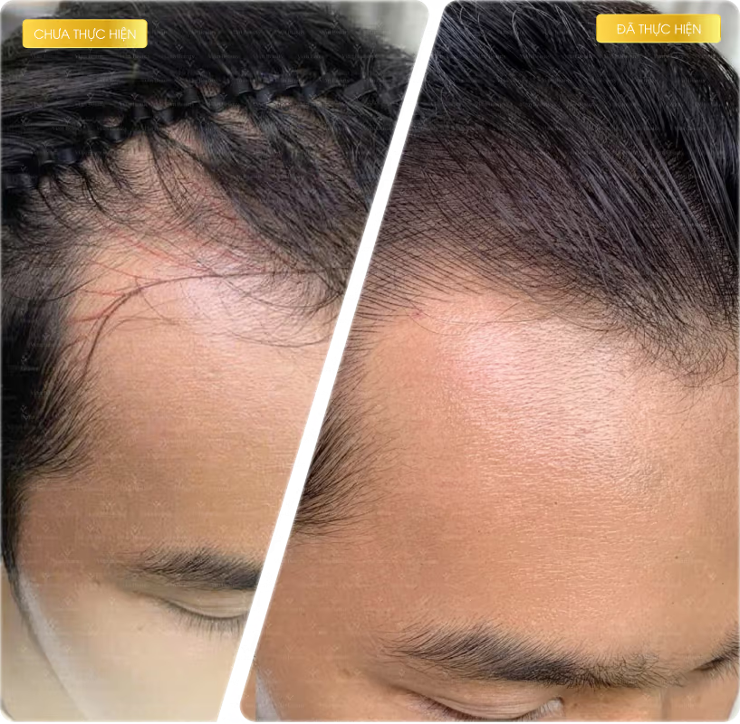 Cảm nhận sau khi điêu khắc sợi tóc tại Vian Beauty 20