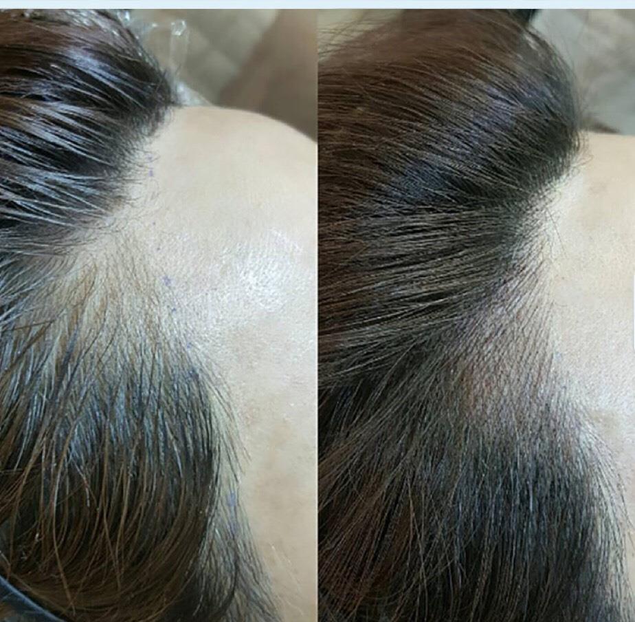 Bảng Giá Phun Xăm Tóc Tại Vian Beauty 24